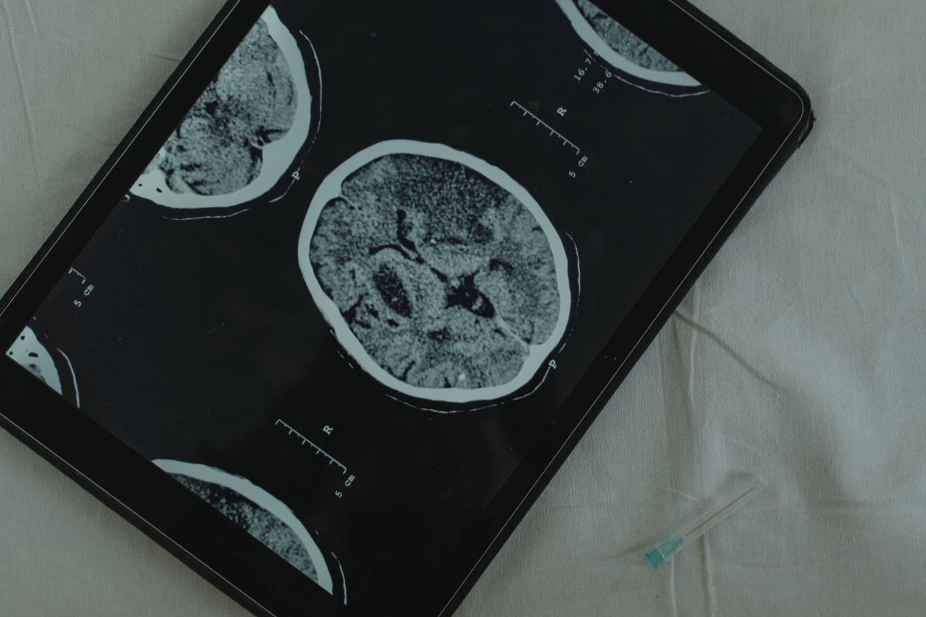 أسئلة شارحة: تقنية الرقائق العصبية (Neuralink)